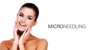 come fare microneedling micro needling passaggi